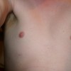 22 years old and still a completley hairless chest! Sorry about the angle, my camera doesn't have a timer!